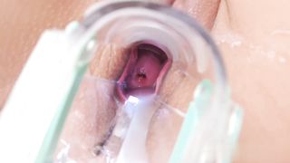 【69堂午夜视频】原本是来内科检查胃部状态的，结果子宫被打开用窥器看到了阴道内部，用注射器将精液注射到体内并进行了中出性交。